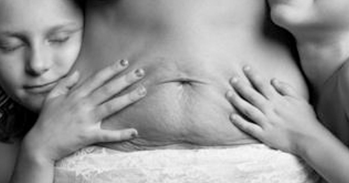 body after pregnancy