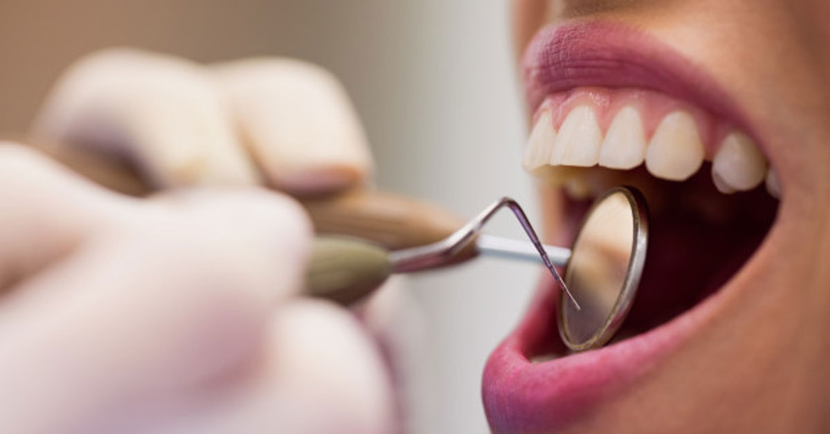 Ουλίτιδα: Τι είναι και πως μπορούμε να την αποφύγουμε για να έχουμε πιο υγιή δόντια και ούλα;